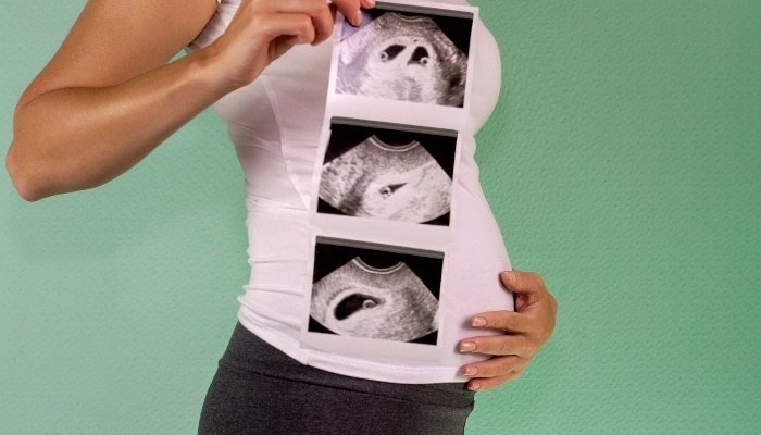 Twin Ultrasound Picture at 4 Weeks