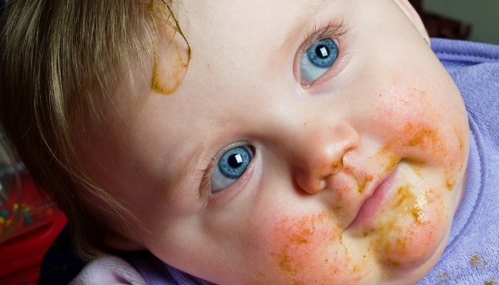 An adorable baby boy with blue eyes sitting in a high chair with a messy face.