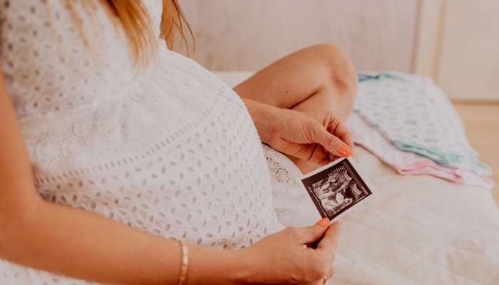 A pregnant woman sitting on the bed holding an ultrasound photo of twins.