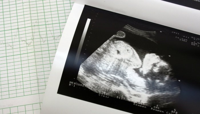 Baby ultrasound image and cardiograph