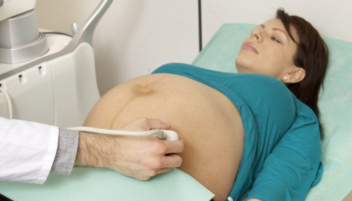 A lady wearing a blue shirt undergoes ultrasound imaging to monitor her pregnancy.
